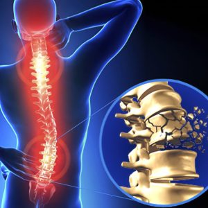 Spinal